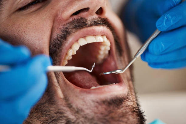 Best Emergency Broken Tooth Repair in Wrightsville, AR