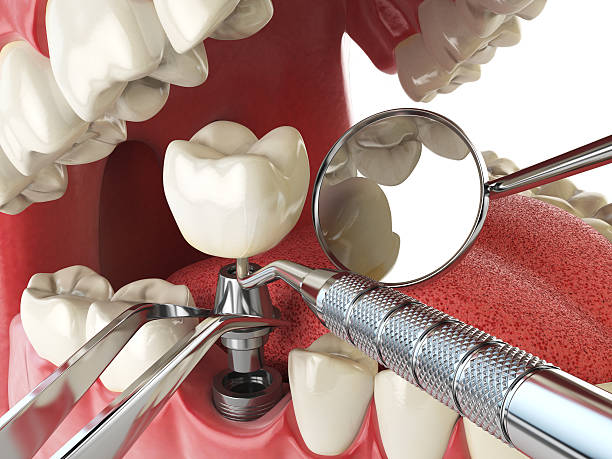 Best Emergency Treatment for Toothache in Wrightsville, AR