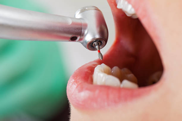 Best Emergency Dental Surgery in Wrightsville, AR